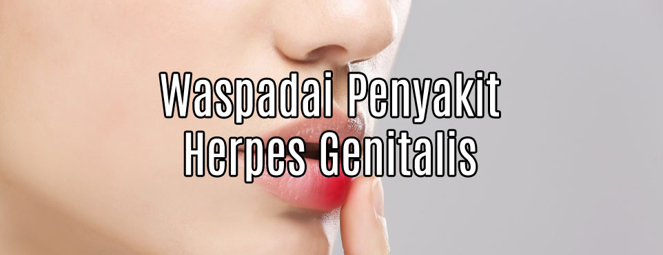 Waspadai Penyakit Herpes Genitalis